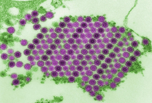 Chikungunya – Das Virus, das sich weltweit ausbreitet